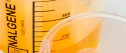 Optimize your ELISpot Assay