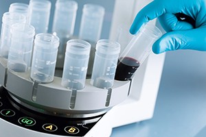 13473_IBA_244 Traceless Affinity Cell Selection