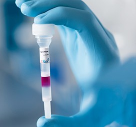13473_IBA_078_rz-1 Protein Purification