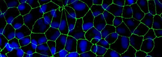 Antibodies