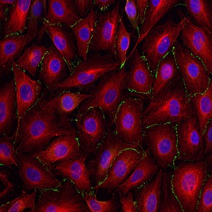 16312_CoraLite_alphatubulincontrol